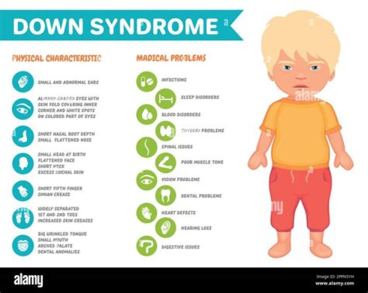 How much can a person with Down syndrome make?